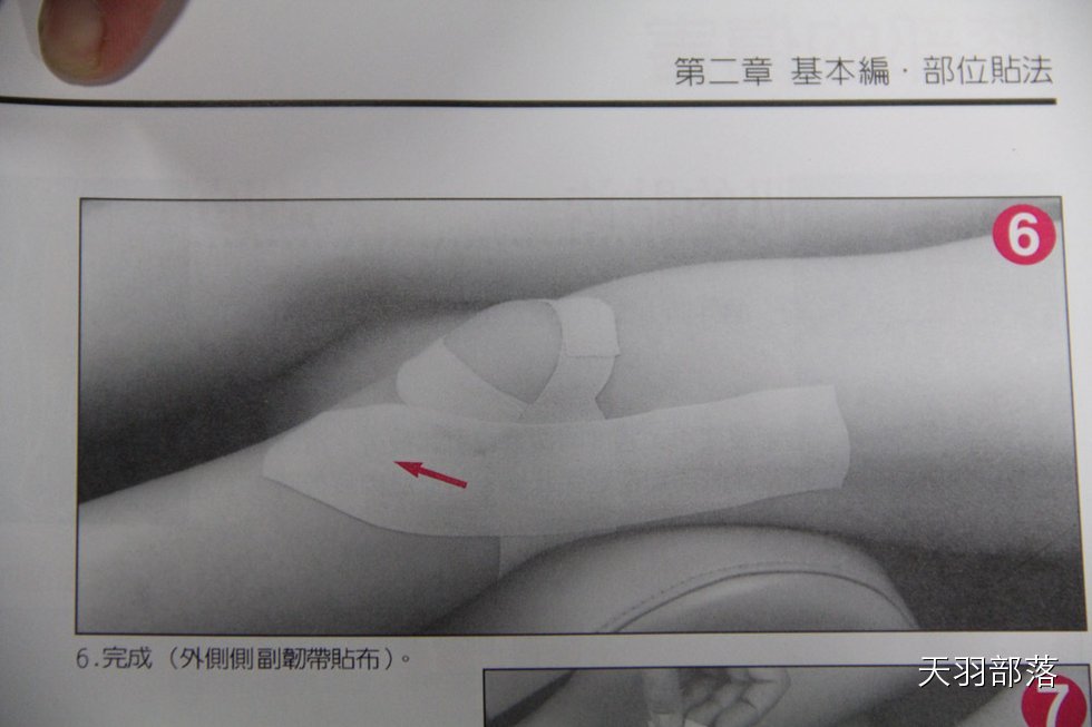 队医出诊之 肌肉贴布的使用大全(二)