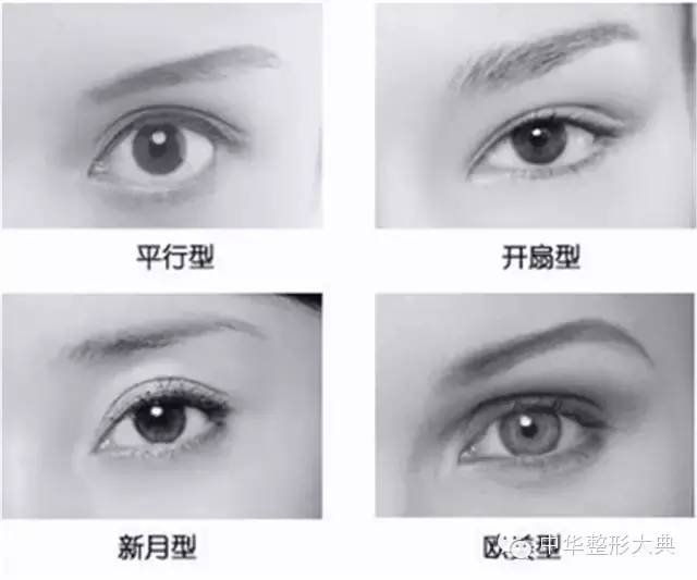广尾型:是指双眼皮皱襞内窄外宽,适应于绝大多数单睑受术者; c.