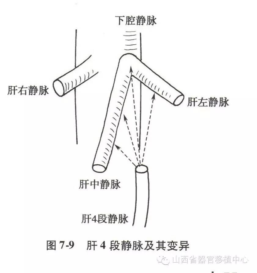 【肝脏解剖】腹部下腔静脉及其肾平面以上属支的解剖