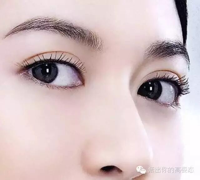 当范冰冰、章子怡、孙俪都没了双眼皮……秒变路人甲!