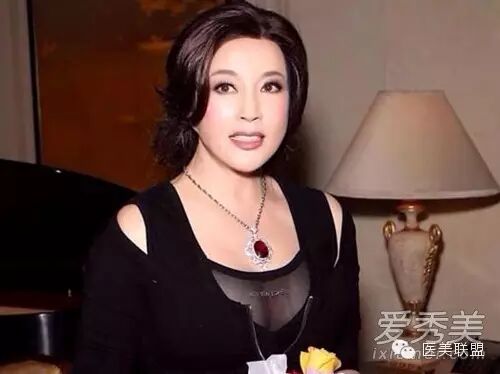 60岁刘晓庆短裙露长腿 谈保养承认微整容