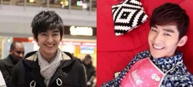 张翰炎亚纶魏晨 揭明星整容前后惊悚对比照