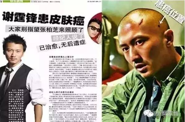谢霆锋患癌症,33岁湖南台导演血癌已逝!震惊不?
