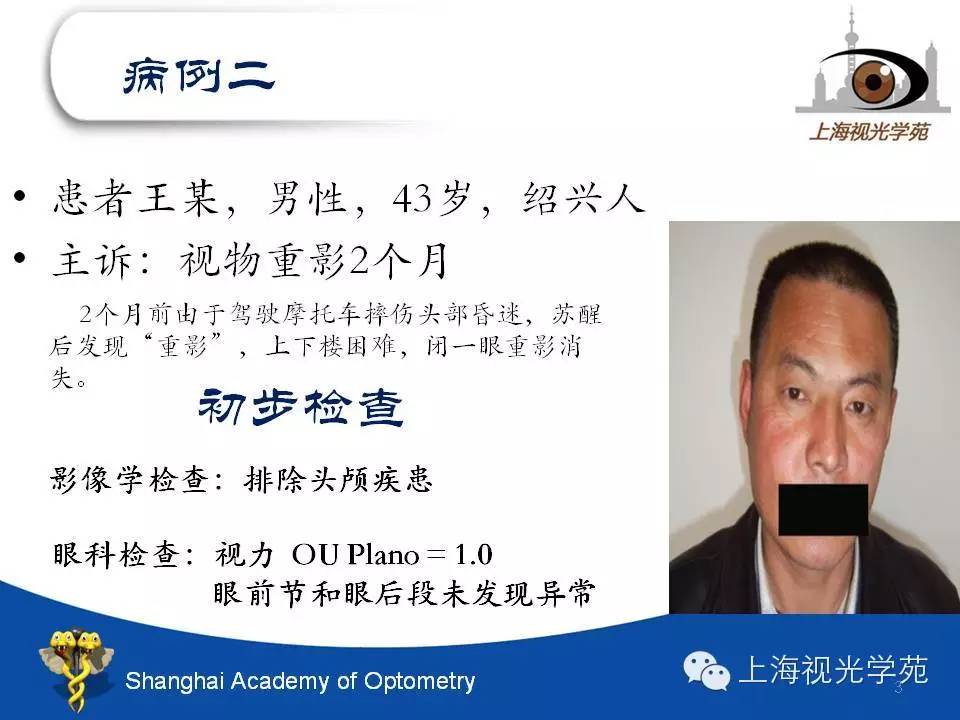 【上海视光学苑微信公开课】上斜肌麻痹的诊断与治疗