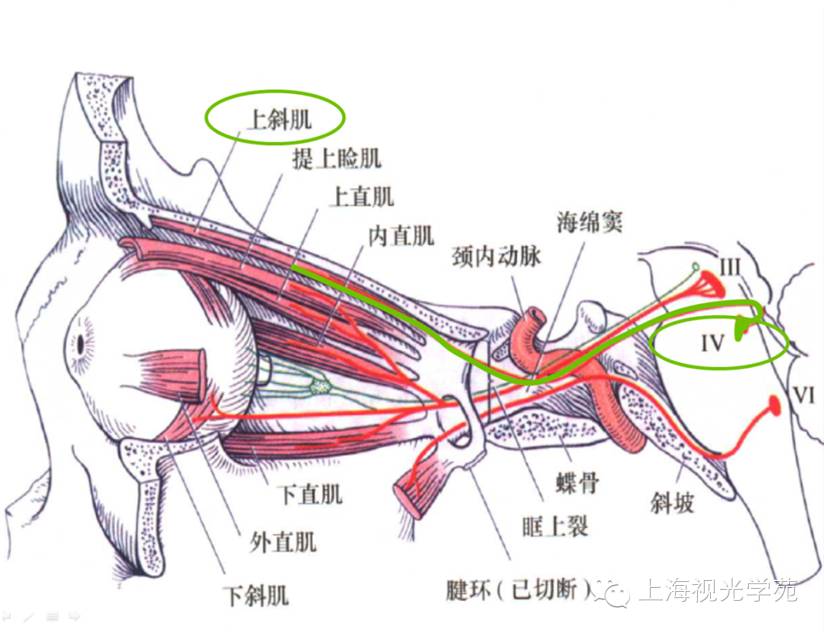 控制上斜肌的神经为滑车神经(图中绿线),它起于中脑下