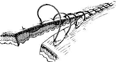 医疗缝线怎么做超全秘籍：临床常用伤口缝合方法（文字+图示+视频）_https://www.jmylbn.com_新闻资讯_第13张