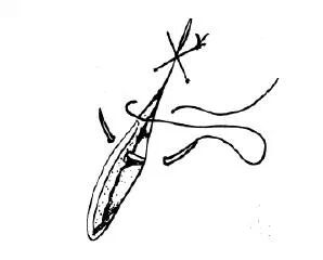 医疗缝线怎么做超全秘籍：临床常用伤口缝合方法（文字+图示+视频）_https://www.jmylbn.com_新闻资讯_第9张