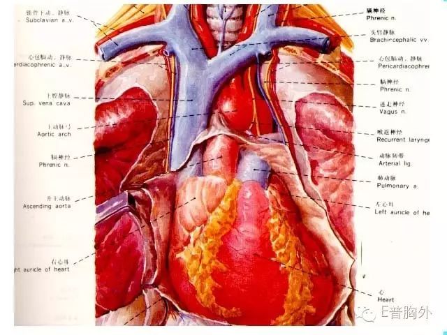 单孔胸腔镜下实施前纵隔肿瘤切除术