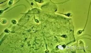 花生君丨同房后精液流出来会影响怀孕吗?-怀孕期