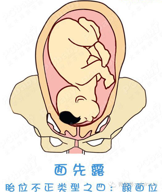 超全胎位示意图孕妇最担心胎儿姿势