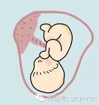 【超全胎位示意图】孕妇最担心胎儿姿势