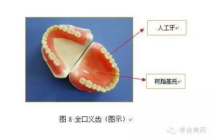什么是定制式义齿您知道定制式义齿是什么吗？_https://www.jmylbn.com_新闻资讯_第7张