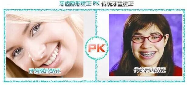 隐形矫正和传统矫正有什么不同呢？
