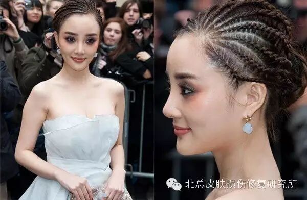 从杨幂,范爷,袁珊珊~看女屌丝到女神的微整形蜕变之路...