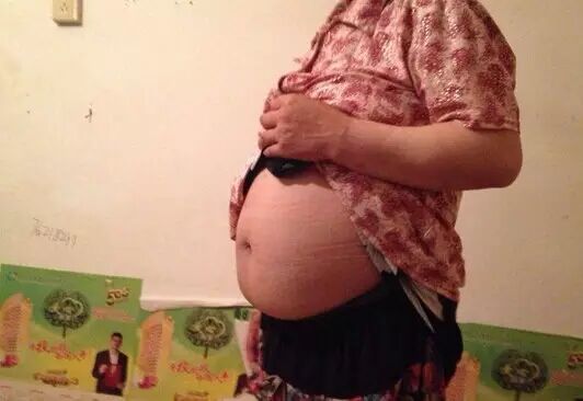 【晓得不嘛】48岁女精神病人在敬老院内怀孕27周 遭院内老人强奸或诱奸?-怀孕期