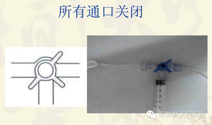 医学‖三通管的使用