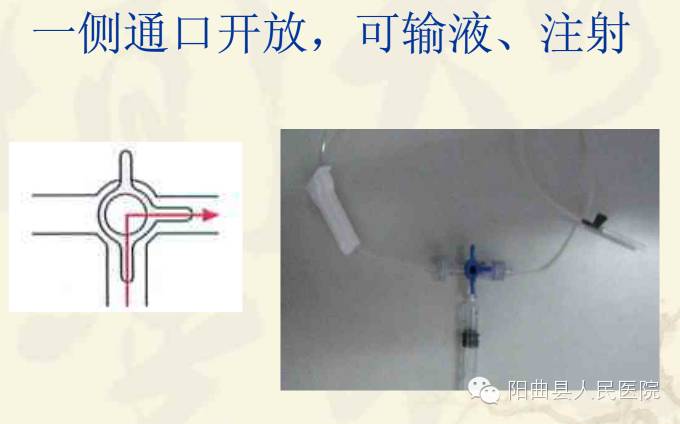 医学‖三通管的使用