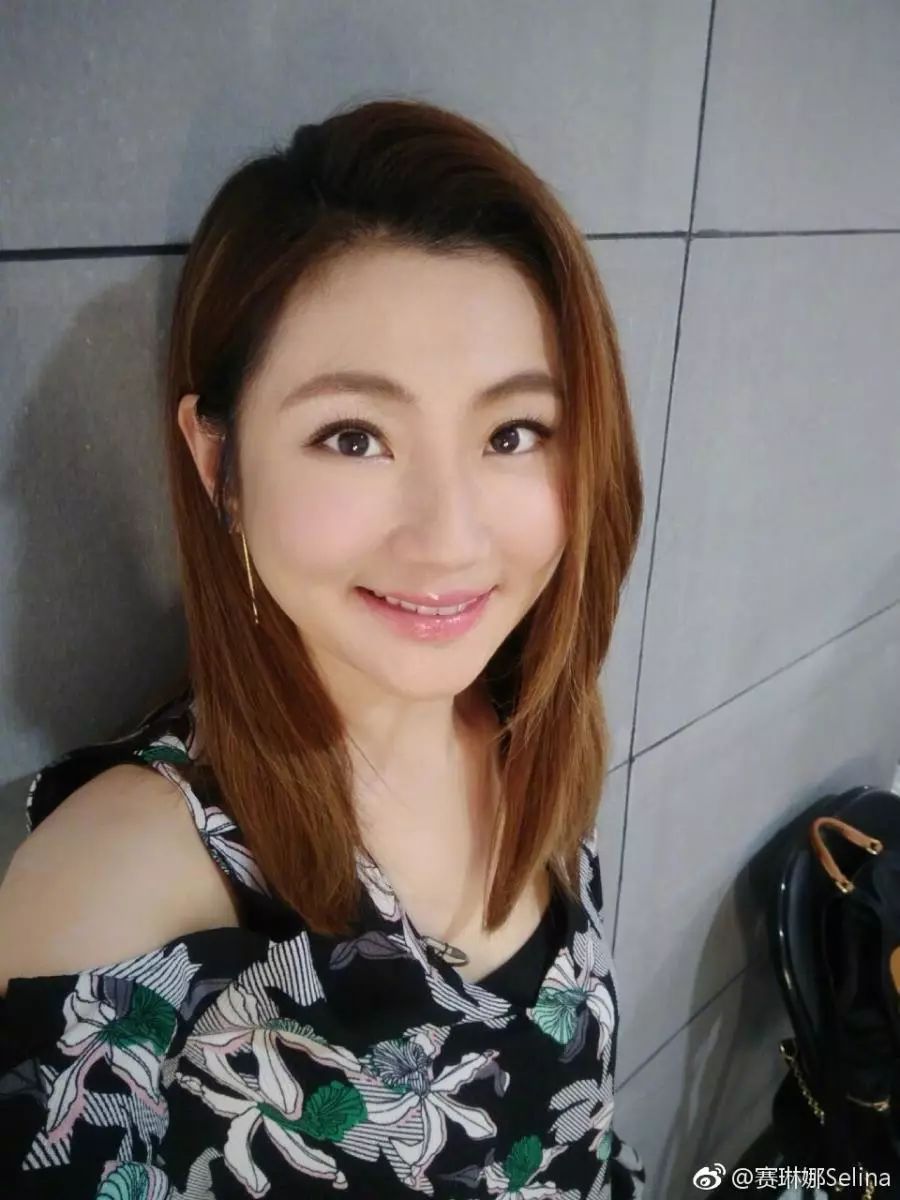 Selina经过7年不断地整容,疤痕修复越来越好,如今长这样