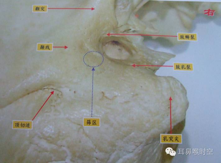 操作步骤详解乳突根治术