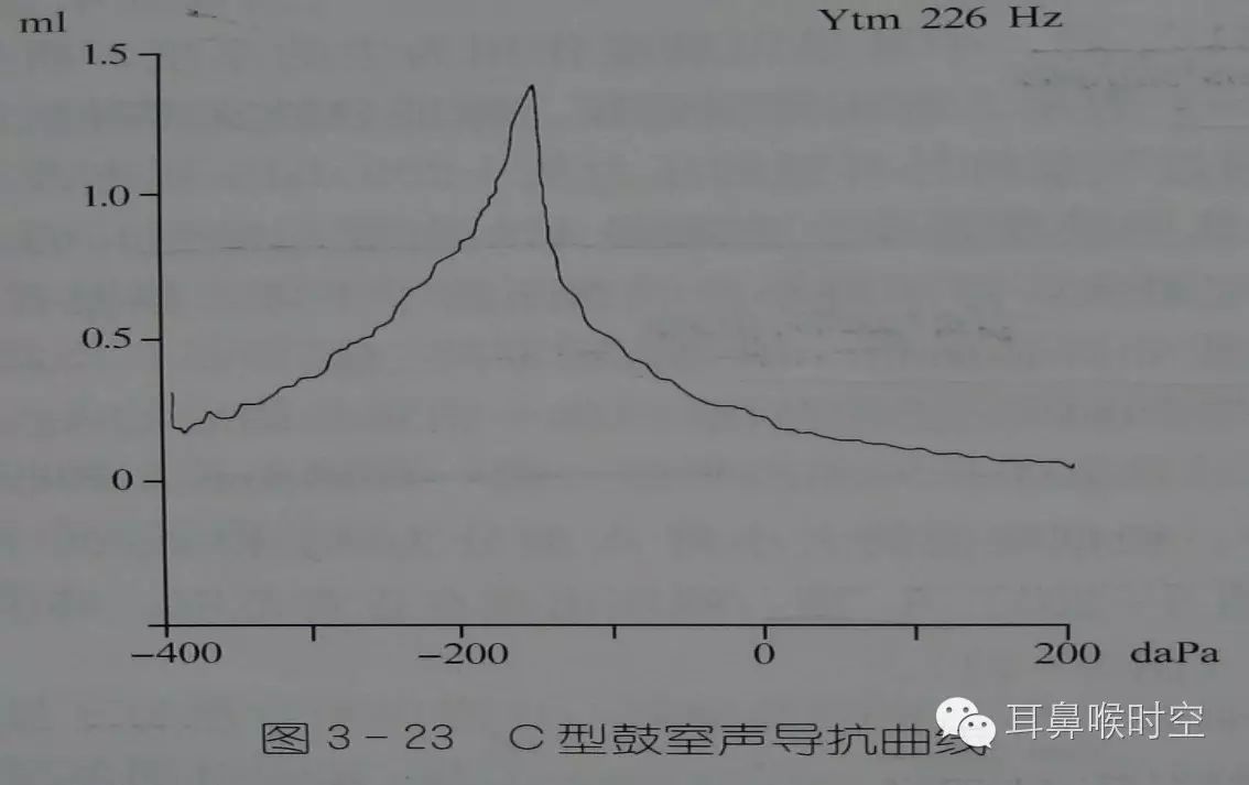 等 常规检查:电耳镜,耳内镜,显微镜 听力学检查:纯音测听,声导抗测听