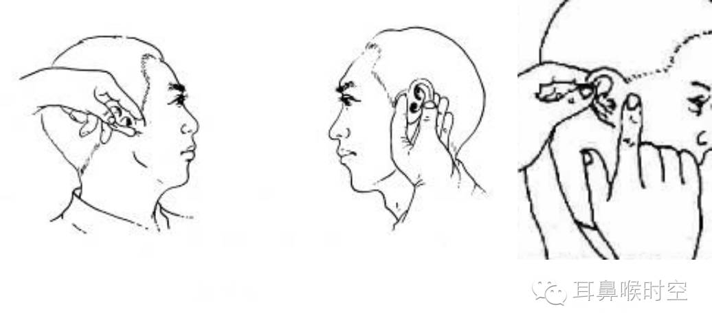 没有耳镜怎么使用耳鼻咽喉常见的检查方法，你值得拥有！_https://www.jmylbn.com_新闻资讯_第19张