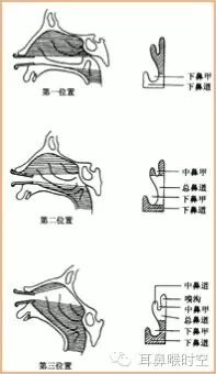 没有耳镜怎么使用耳鼻咽喉常见的检查方法，你值得拥有！_https://www.jmylbn.com_新闻资讯_第7张