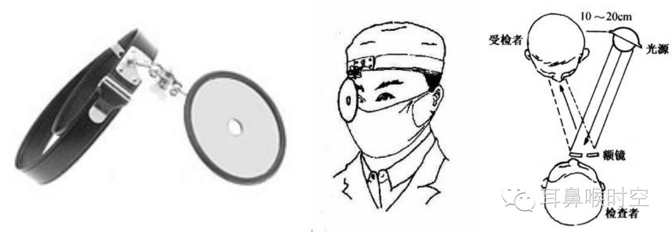 没有耳镜怎么使用耳鼻咽喉常见的检查方法，你值得拥有！_https://www.jmylbn.com_新闻资讯_第3张