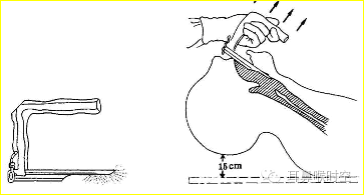 没有耳镜怎么使用耳鼻咽喉常见的检查方法，你值得拥有！_https://www.jmylbn.com_新闻资讯_第16张