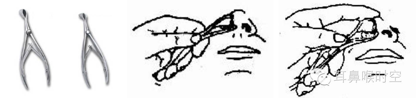 没有耳镜怎么使用耳鼻咽喉常见的检查方法，你值得拥有！_https://www.jmylbn.com_新闻资讯_第6张