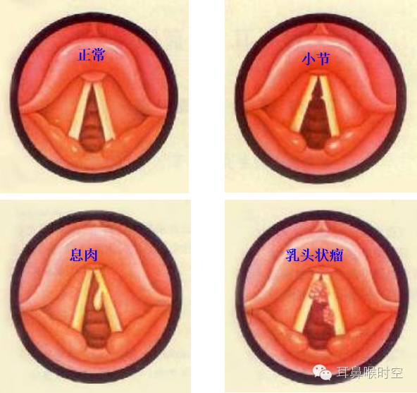 没有耳镜怎么使用耳鼻咽喉常见的检查方法，你值得拥有！_https://www.jmylbn.com_新闻资讯_第15张