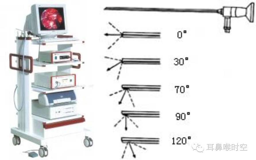 没有耳镜怎么使用耳鼻咽喉常见的检查方法，你值得拥有！_https://www.jmylbn.com_新闻资讯_第9张