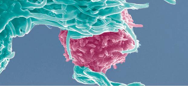 揭秘炎症和癌症发生的关联之谜