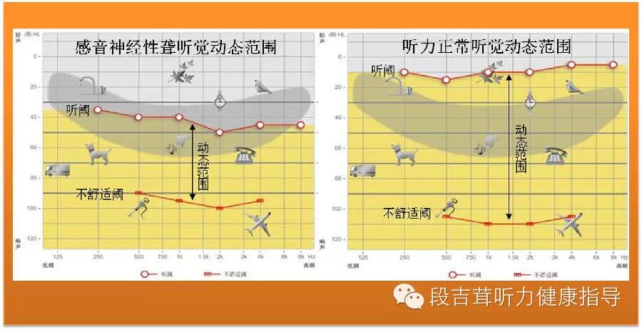 [转载]【听力健康·测听】鞭炮声为何声声震耳?了解你