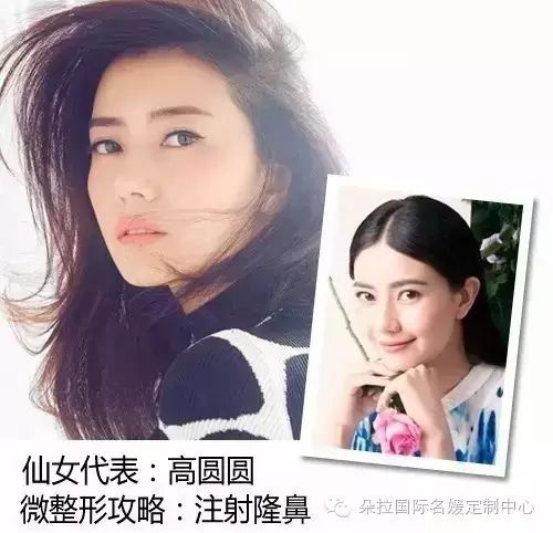 范冰冰、Angelababy:我们都没做整容,我们只做微整形!