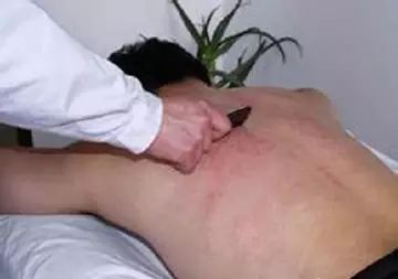 女人经常刮痧，原来有这么多的好处！