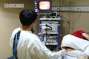 智能检查,肠道的守望者——无痛日本奥林巴斯电子肠镜