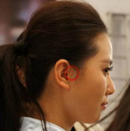 刘诗诗为何总把右耳遮住?原来有这缺陷