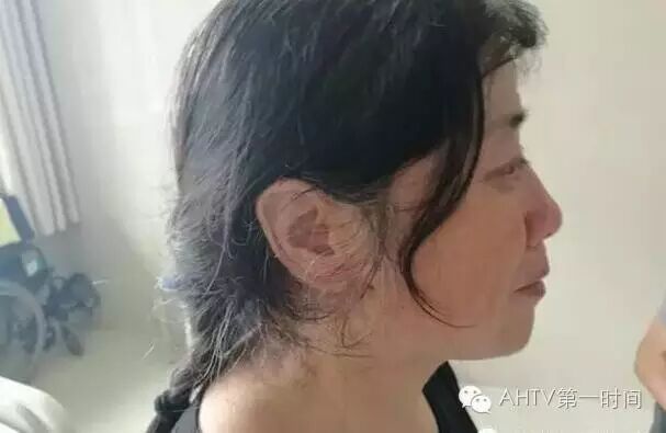 急需帮助!芜湖女子怀孕7个月却胎死腹中,连遭厄运的她命悬一线!-怀孕期