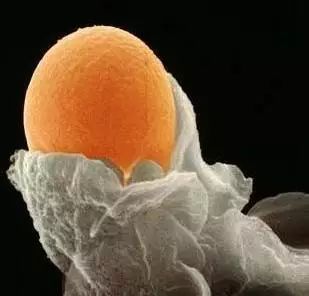 备孕须知:卵泡长大了,却不排卵,这是怎么回事?