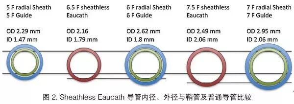 桡动脉鞘怎么读陈晖：经桡动脉无鞘指引导管的应用经验介绍——7.5F Sheathless Eaucath导引导管使用经验_https://www.jmylbn.com_新闻资讯_第2张