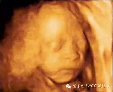 怀孕后咋会出现下腹部疼痛-怀孕期