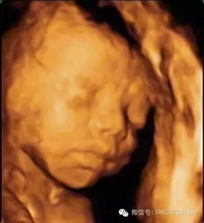 怀孕后咋会出现下腹部疼痛-怀孕期