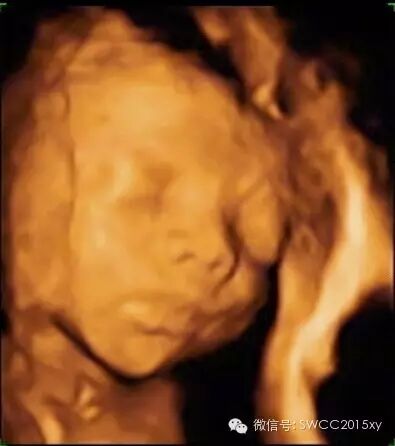 怀孕后咋会出现下腹部疼痛-怀孕期