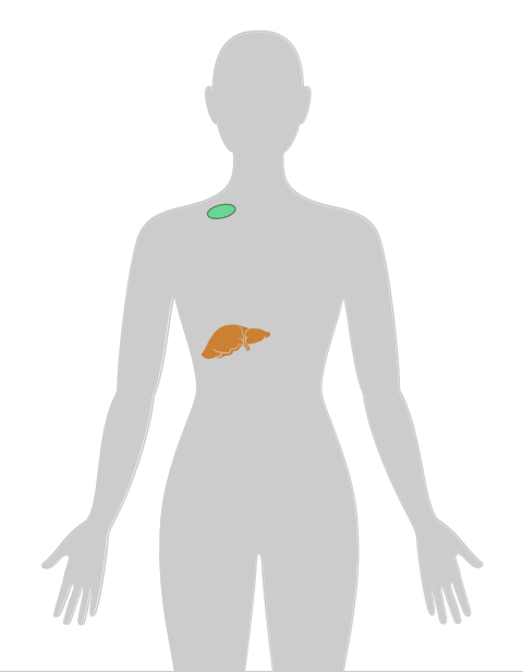 20张癌症人体地图，告诉你致癌真相