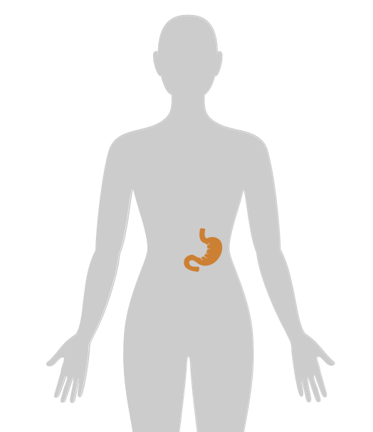 20张癌症人体地图，告诉你致癌真相