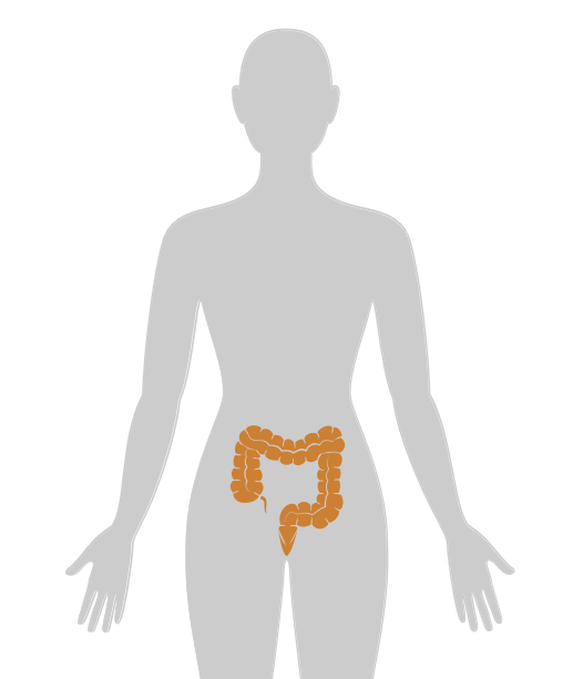 20张癌症人体地图，告诉你致癌真相