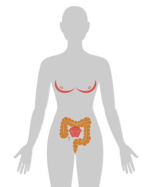 20张癌症人体地图，告诉你致癌真相