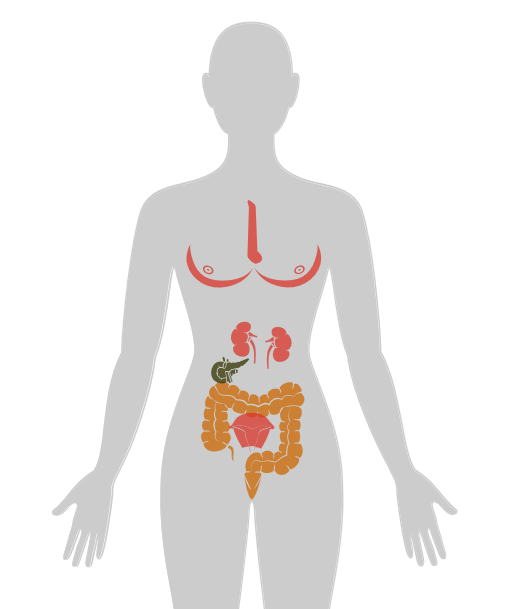 20张癌症人体地图，告诉你致癌真相