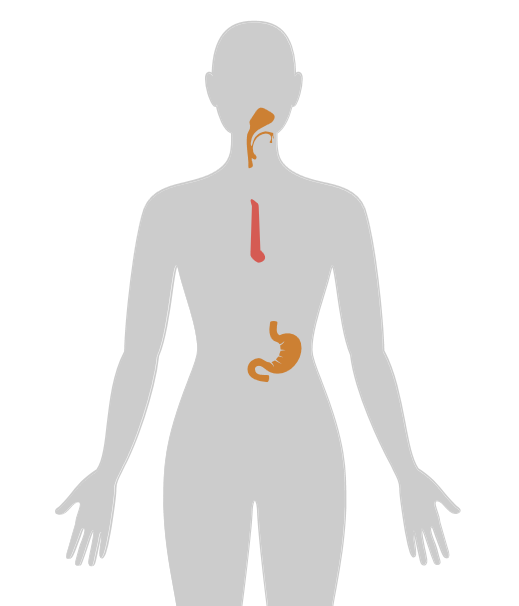 20张癌症人体地图，告诉你致癌真相