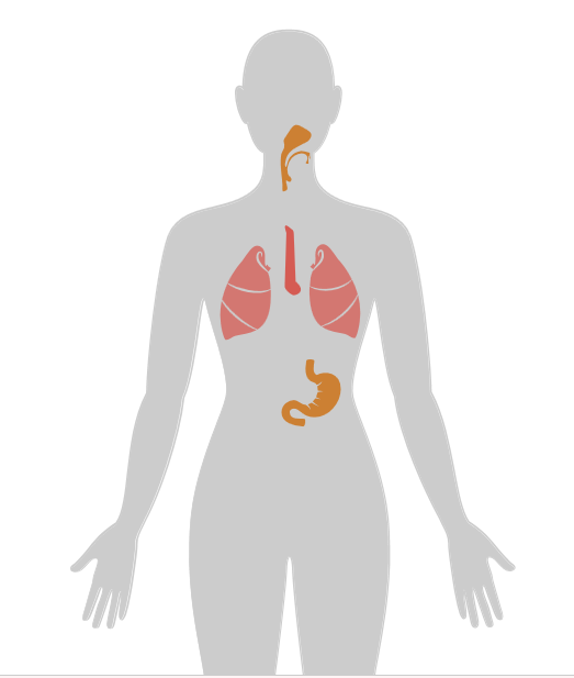 20张癌症人体地图，告诉你致癌真相
